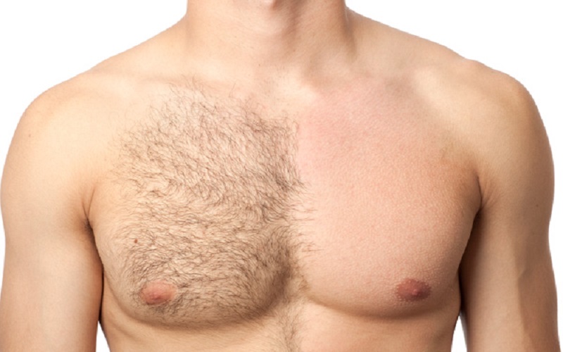 chest waxing hair removal in kensington and chelsea holland park
